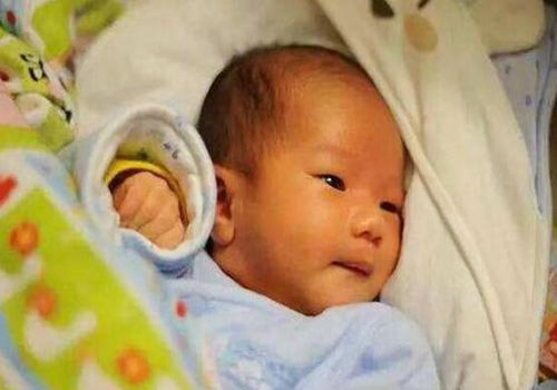 黄疸如何判断是生理还是病理性,新生儿怎么区分生理和病理性黄疸