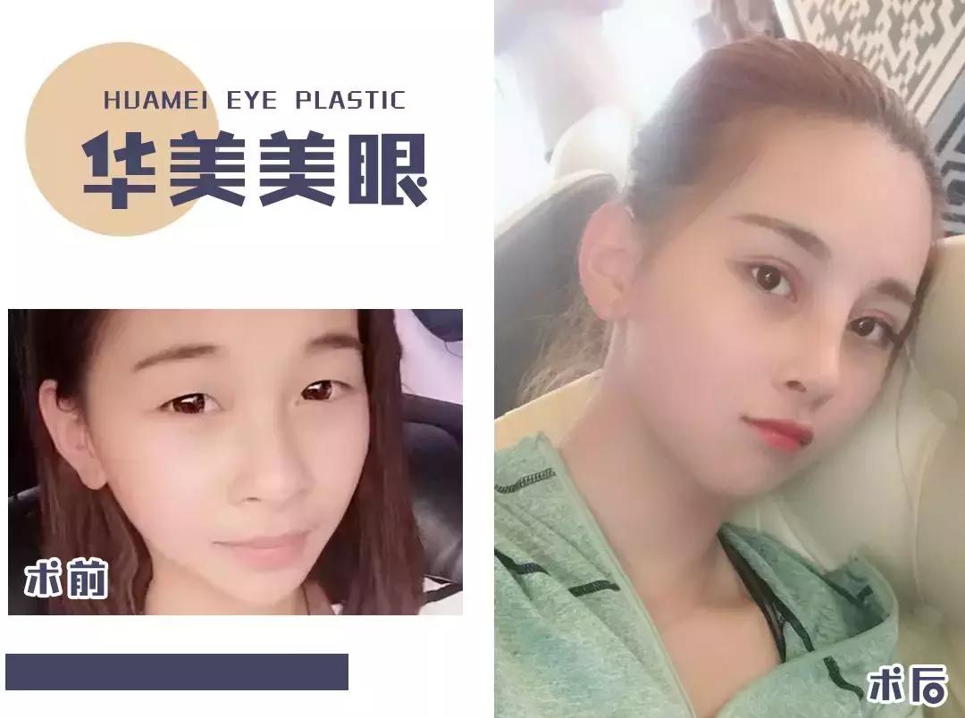 8.8元带你追李现！汕头女孩终于实现1折“变脸”