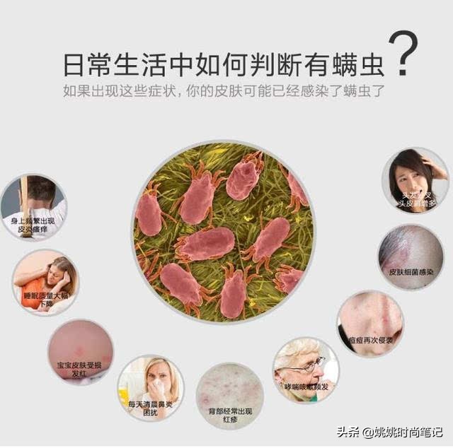 硫磺皂真的能够祛痘吗,硫磺皂真的能祛痘除螨吗