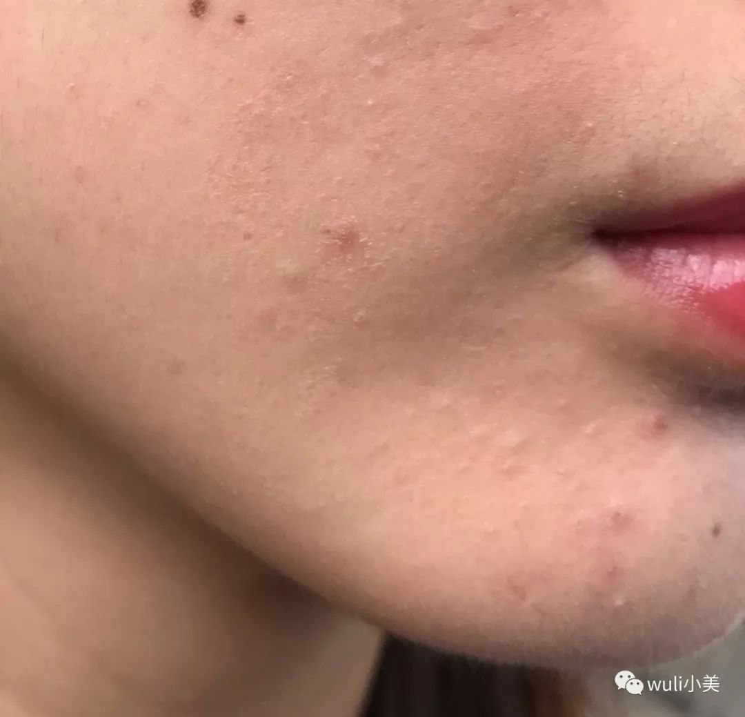 兰蔻遮瑕磨皮棒,兰蔻粉底液混干皮测评