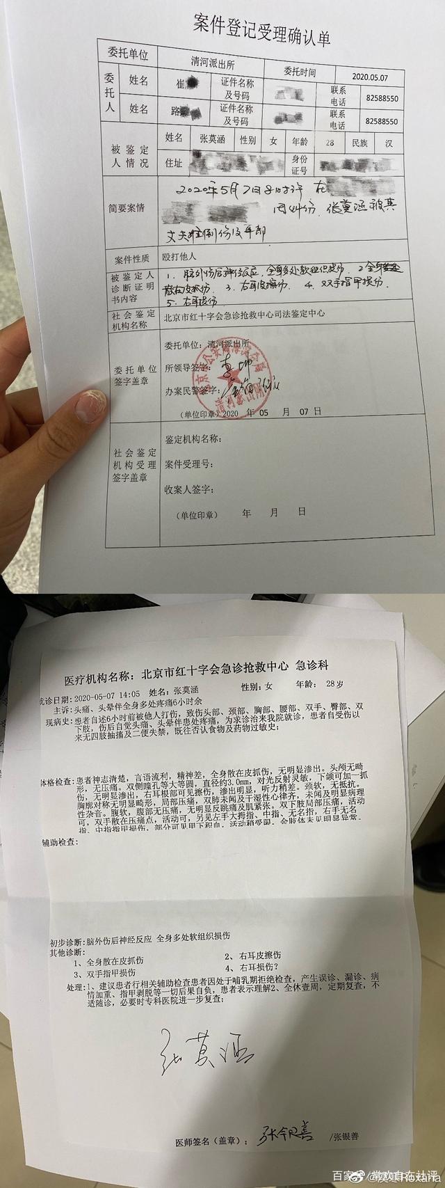 美女主播爆运动员丈夫孕期家暴还被拔指甲，男方甩锅激素太无语