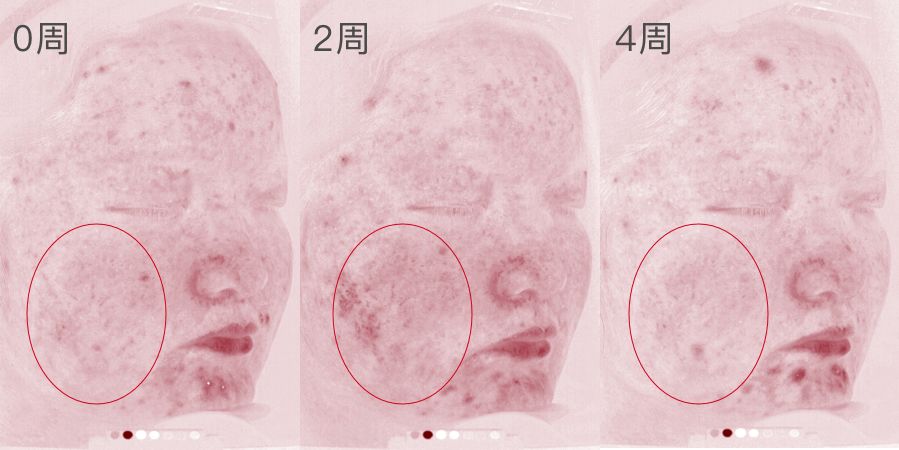 sk-II神仙水真的好用吗,SK-II神仙水好用吗