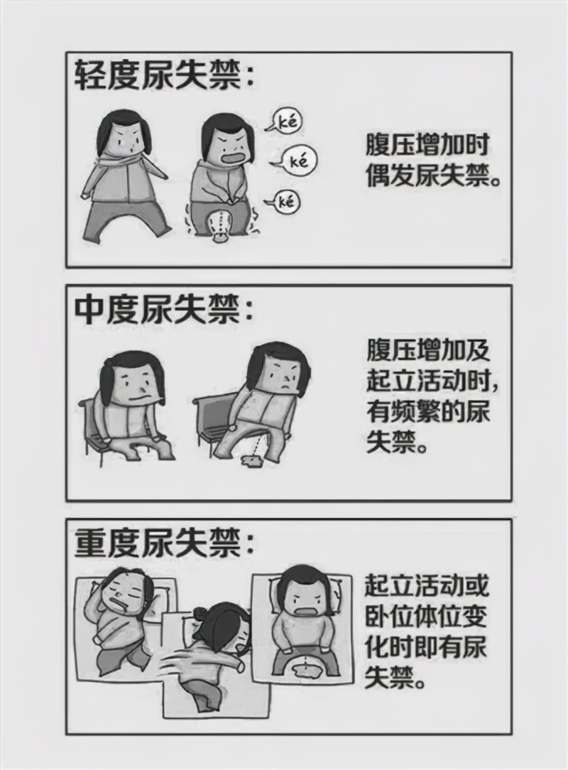 盆底康复治疗多少钱,盆底康复治疗过程图解