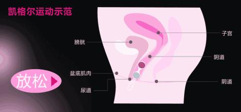 笑会笑出尿来是不是病,笑是好事还是坏事