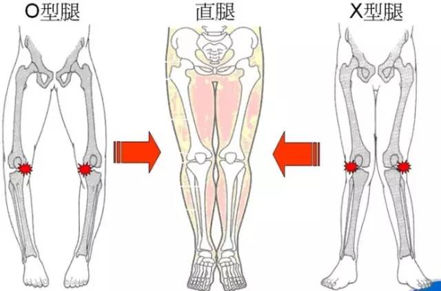 想一生不生病请记住这几条,无伤跑才是最重要的