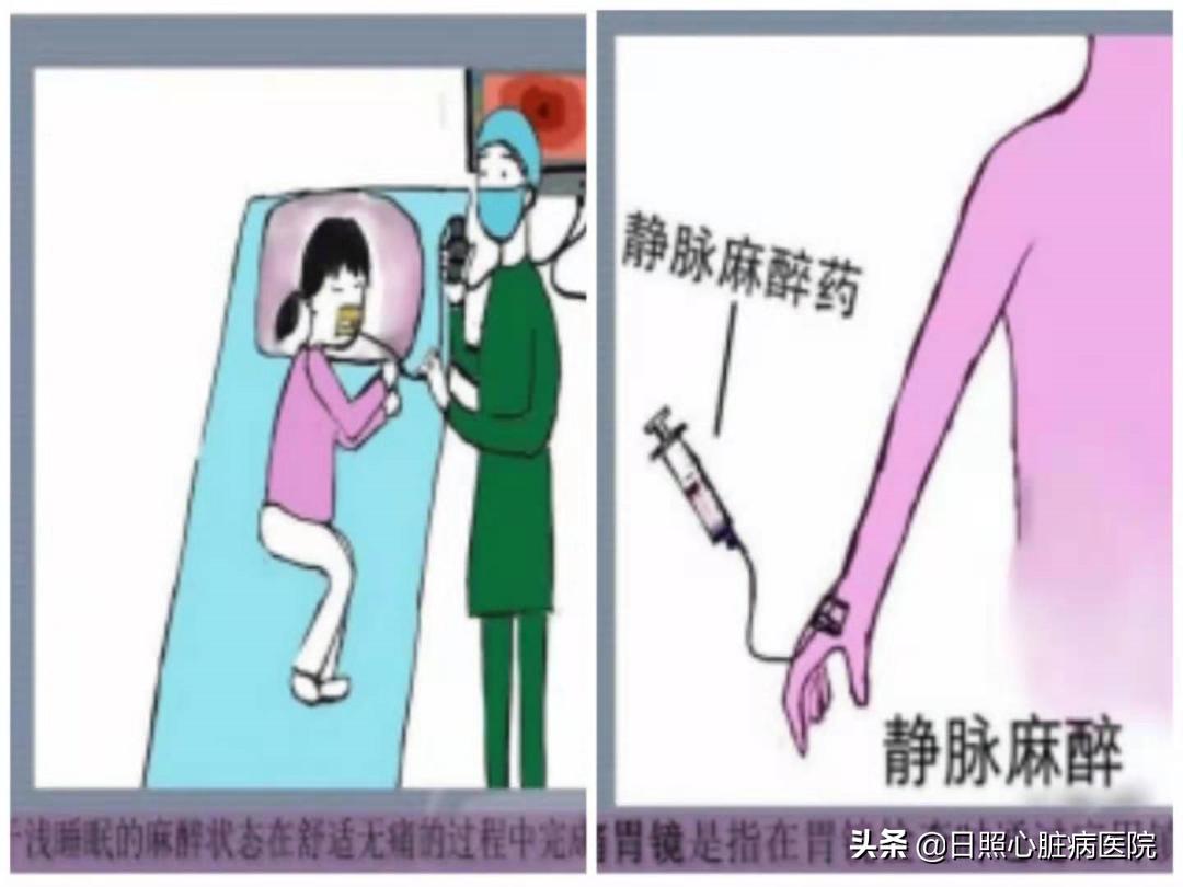 原来胃肠镜检查能够如此轻松,真实胃肠镜