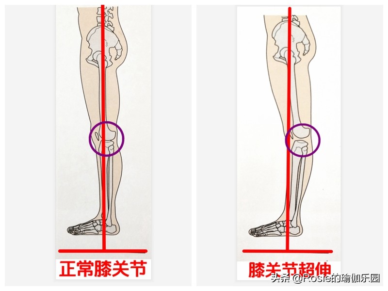 肌肉型小腿粗壮外翻如何变细腿,小腿粗壮如何变细腿健身动作