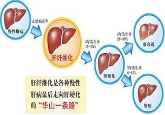 乙肝治愈后肝纤维化能逆转吗,乙肝纤维化逆转