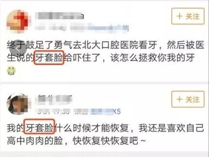 龅牙矫正牙套脸,牙套能够矫正脸歪吗