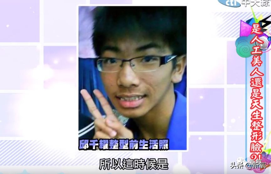 花90万从头整到脚，还能够这么自然？旁边纯天然小姐姐都看懵了
