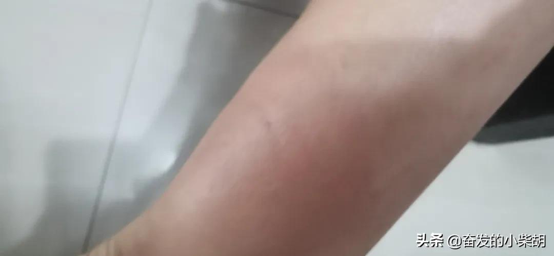 如果遇到红火蚁应该如何自救,红火蚁入侵要小心行家帮你划重点