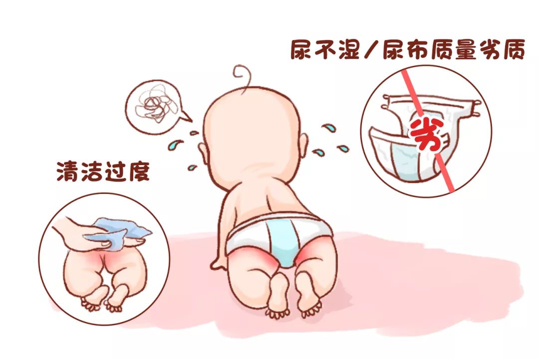 宝宝“红屁股”反反复复？别总让纸尿裤背锅，孕妈护理也有错