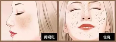 打美白针有副功能吗,常年打美白针有什么副功能吗
