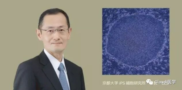已告捷两例！研究发现：移植正常眼部干细胞可治疗失明