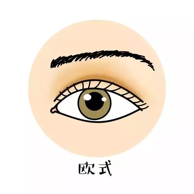 欧式大平行双眼皮什么意思,欧式双眼皮合适什么样的人割