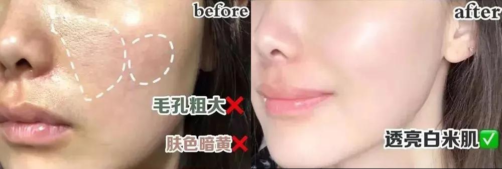 去角质慕斯能够去除死皮么,去角质慕斯去不去死皮