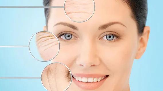 什么样的人合适做面部除皱术,关于面部除皱的常见问题有哪些