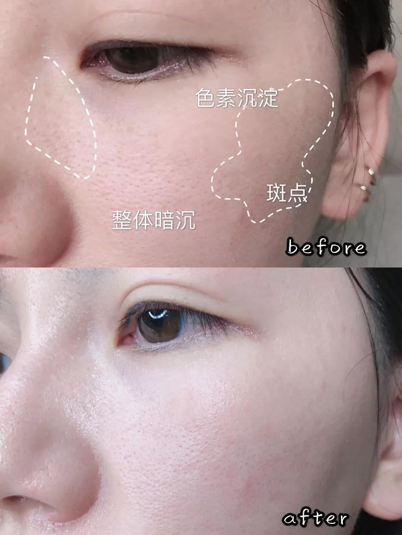 沈梦辰透露自己变白的方法,男朋友说你黑啥意思