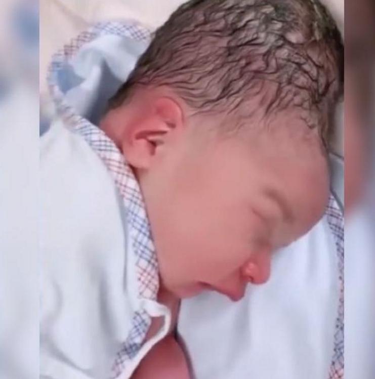 产妇用力不当胎儿头型会变吗,产妇用力不当导致胎儿头部畸形