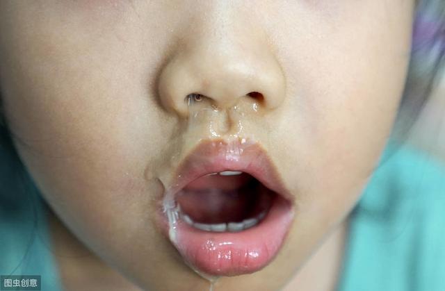 孩子总是流鼻涕咳嗽不好,孩子总是流鼻涕也不发烧还有痰