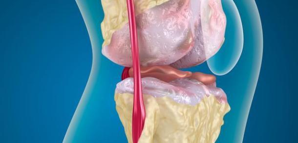 初中生跑步跑完膝盖痛怎么办,跑完步膝盖有点疼还能再跑步吗