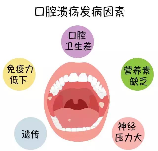 为什么会长口腔溃疡是上火了吗,反复口腔溃疡别以为是上火了