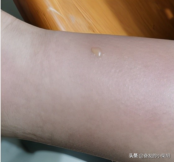 如果遇到红火蚁应该如何自救,红火蚁入侵要小心行家帮你划重点