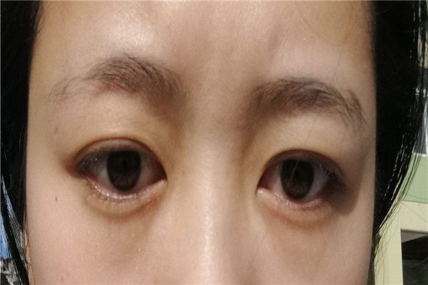 甲状腺症状有哪些明显表现,甲状腺出现问题了身体有哪些症状