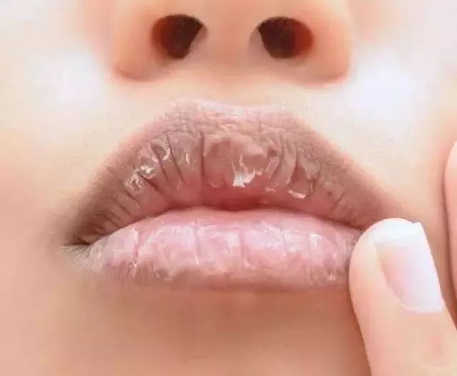 护唇没做好，再怎么好看的口红都没用