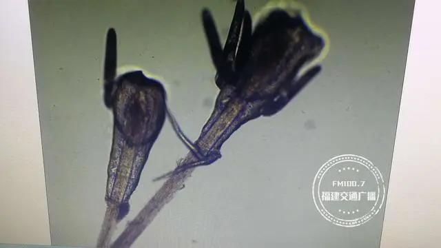 福州一女子狂掉眉毛，一查竟发现是螨虫作祟！医生:要选择正规的医疗机构做项目