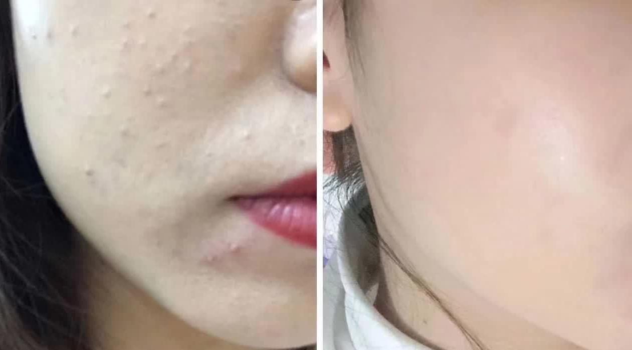 李佳琦阿玛尼和tf粉底液哪个好用,李佳琦阿玛尼大师粉底液