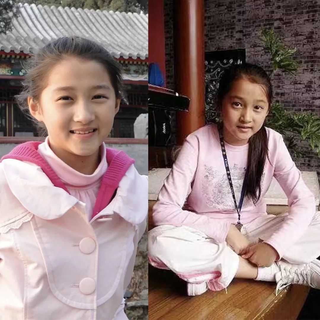 关晓彤有没有黑眼圈,关晓彤黑眼圈困扰