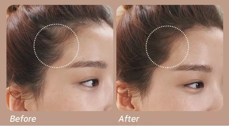 脸大的女生合适哪种脸型,女生脸大的5大特征
