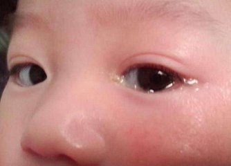 钧钧妈分享：新生儿吐奶、打嗝、腹胀、黄疸……，怎么办？