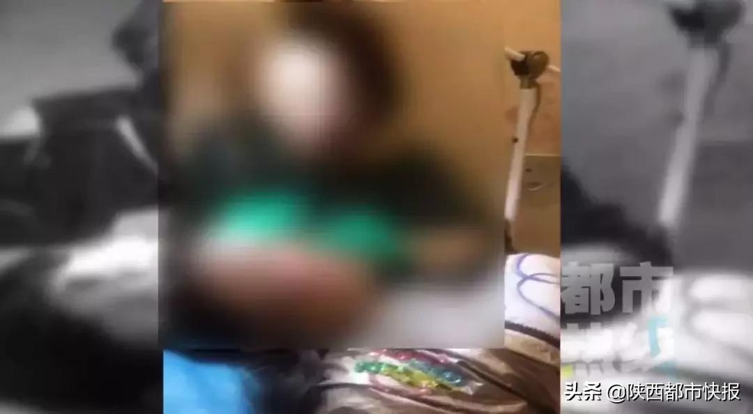 女子打童颜针修复,一女子打瘦脸针毁容