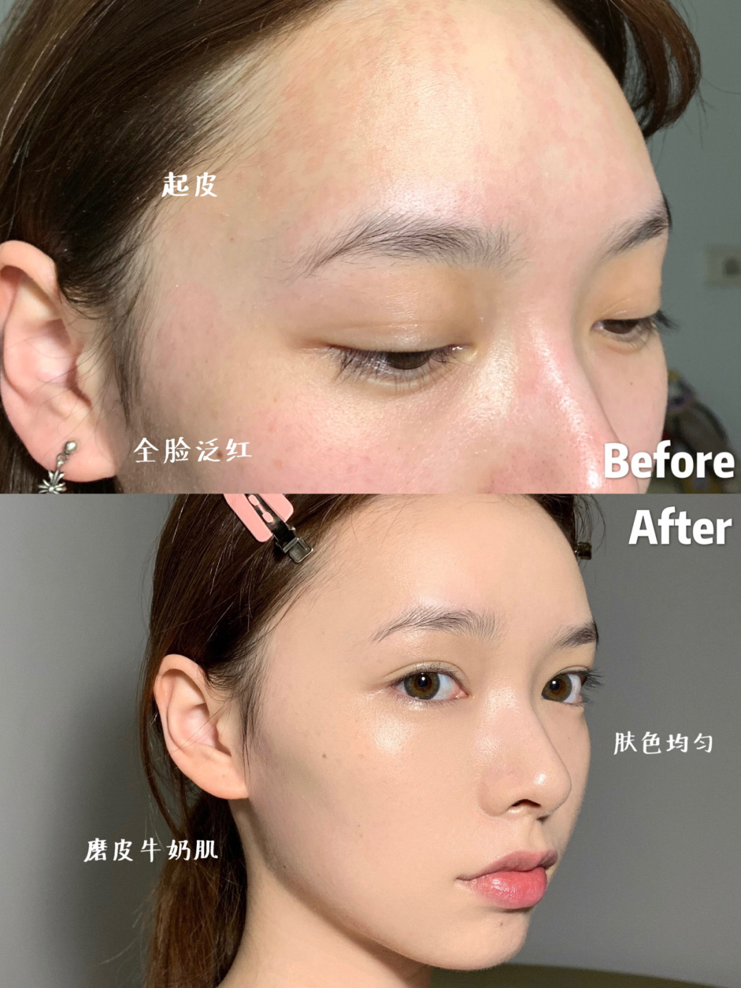 黛玛蔻遮瑕膏遮盖斑点无美颜滤镜,黛玛蔻遮瑕霜能够遮纹身嘛