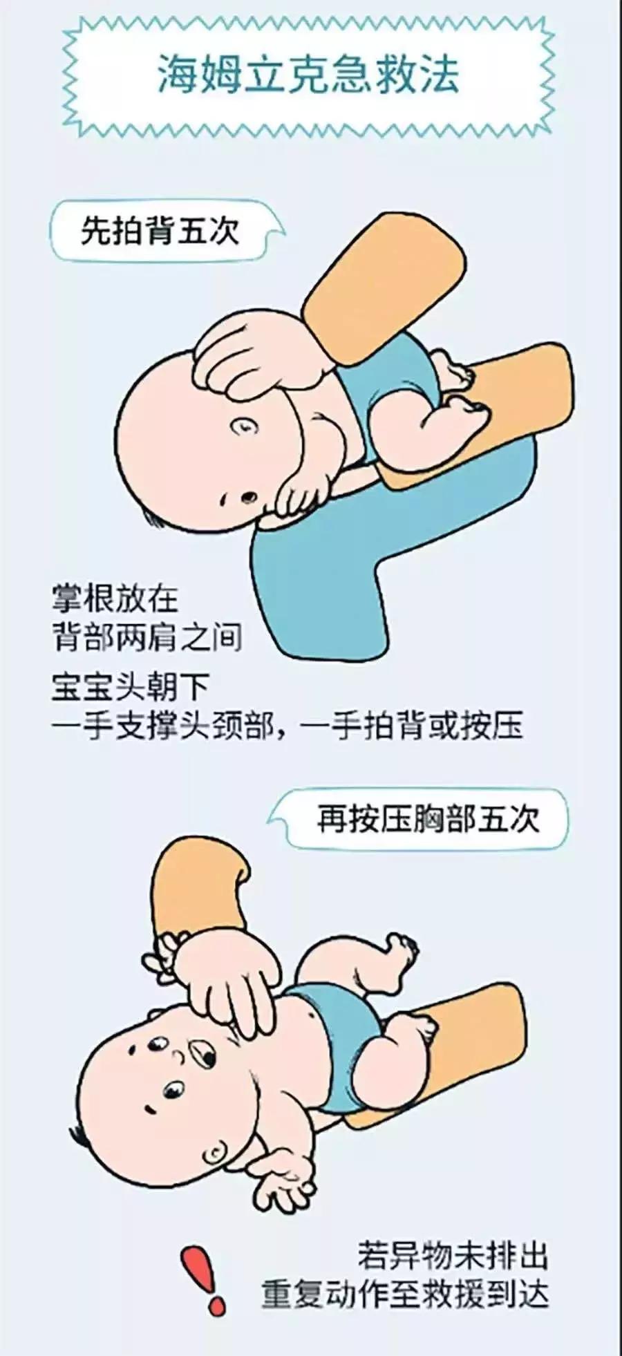 如何预防误吸,误吸急救流程详解