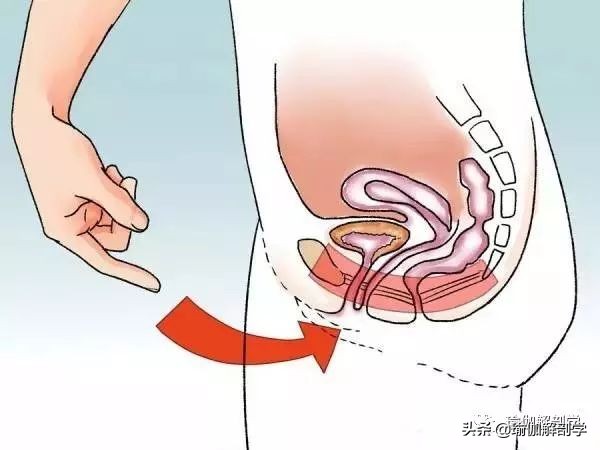 怎样有助于盆底肌修复 (多年盆底肌怎样才能修复)