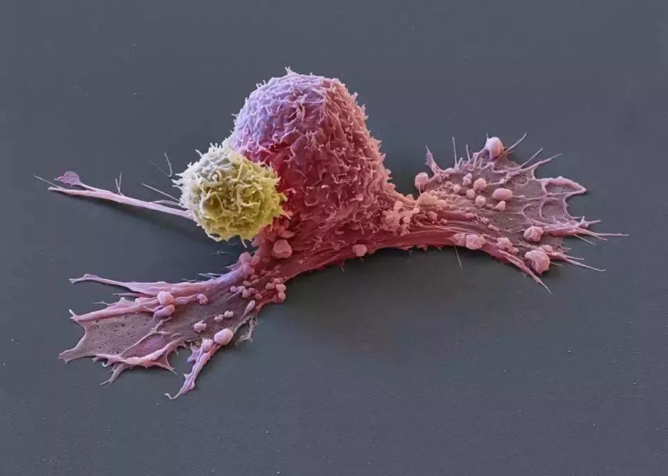 癌症死亡后身体的细胞,死于癌症后细胞永生