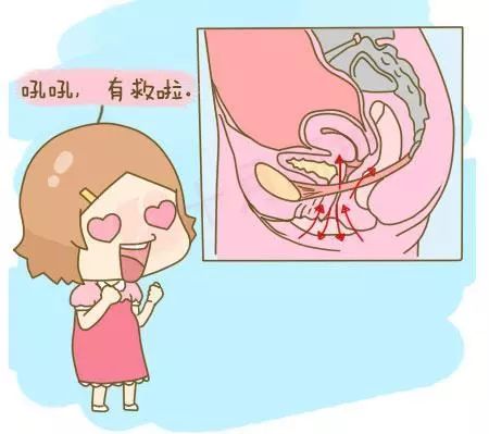 产后修复盆底肌凯格尔运动广告,产后多久能够做盆底肌修复运动