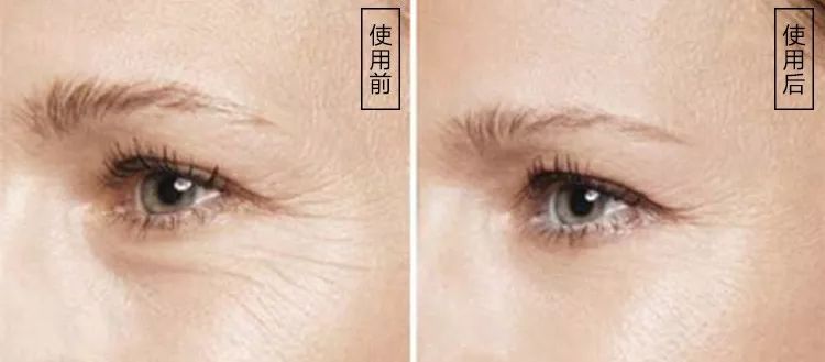 45岁没皱纹看起来像25岁，是如何做到的？