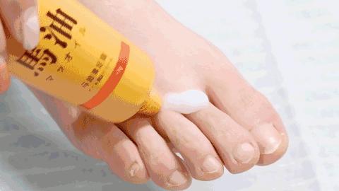 脚气脚臭难去除教你一招能够试试,脚臭脚气脚痒脱皮干裂一招根除