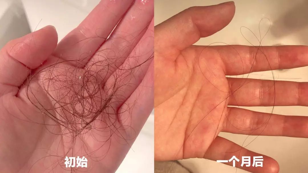 推荐一款真正的防脱发洗发水,推荐一款防脱发洗发水女士