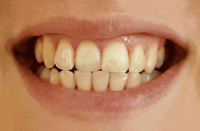 俄罗斯牙膏美白去口臭牙黄,去牙垢黄牙的牙膏测评