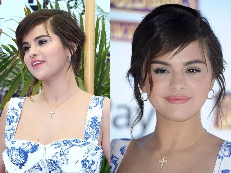 脖子为什么会有一道杠,脖子上出现几道杠会得什么病