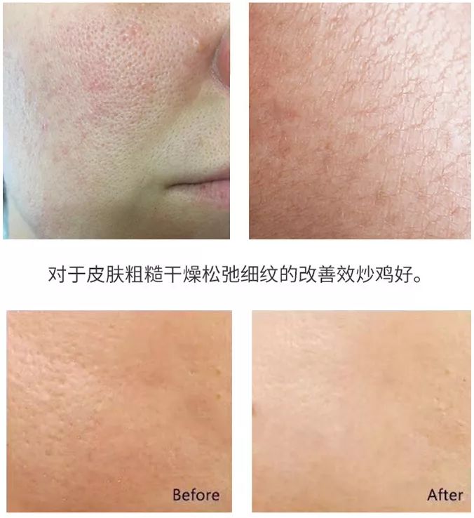安瓶补水紧致提拉去皱精华,嫩白抗皱安瓶精华