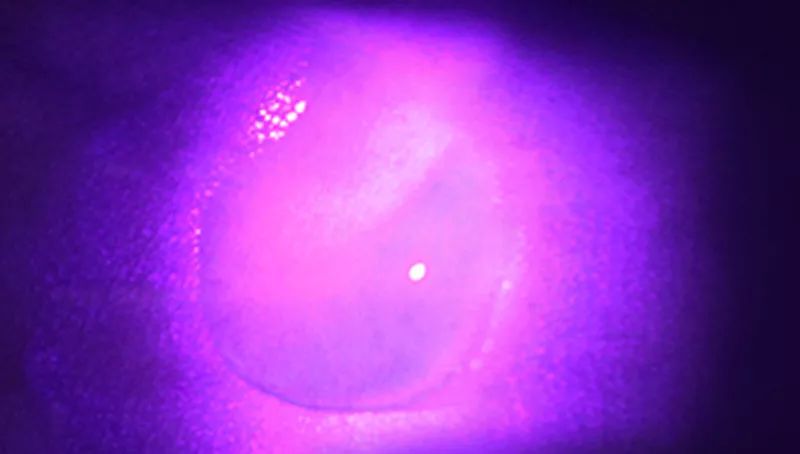 合适黑皮和黄皮的面膜,合适黄皮的mm面膜