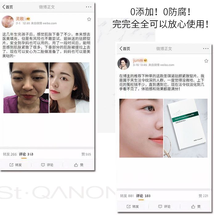 法令纹的细纹去除最好的方法,怎么补救法令纹上的细纹