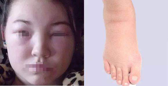 每天2袋，A4小蛮腰、精致小V脸、性感大长腿，你都能拥有