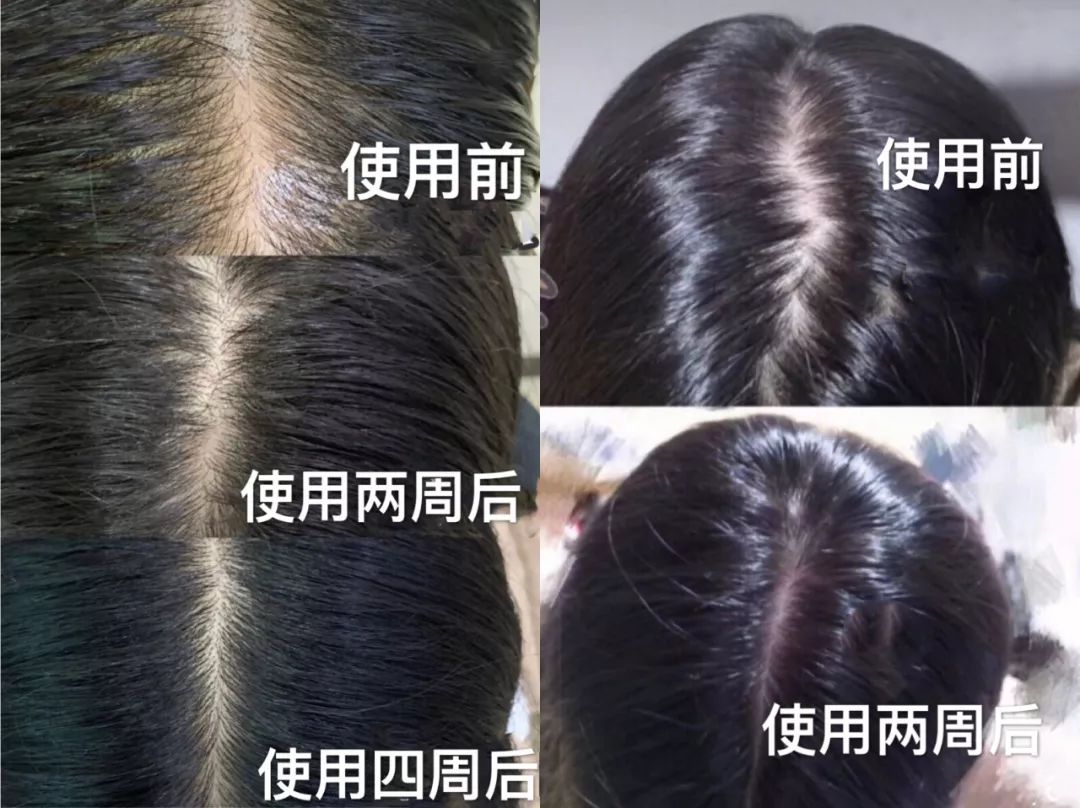 香味浓郁持久偶像的洗发水推荐,2018年最好用的洗发水